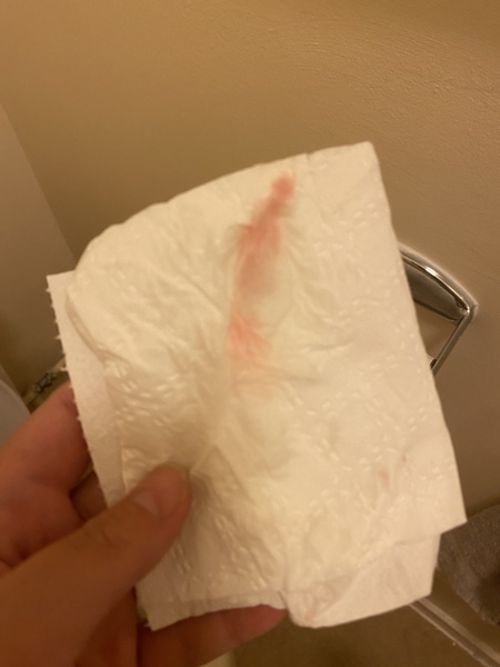 TMI blood picture - 36w pregnant
