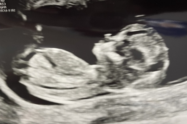 Due February 2022 (thread 2)