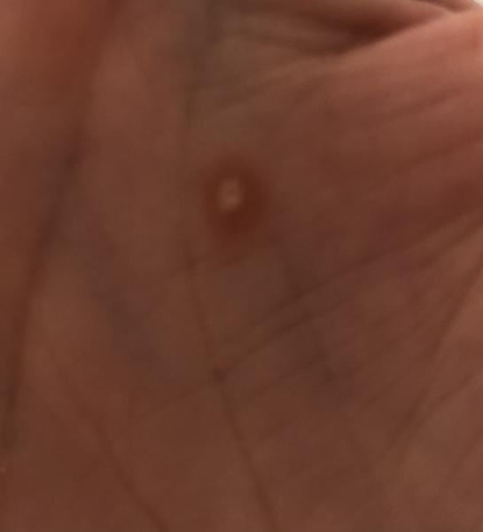 What is this? With picture.