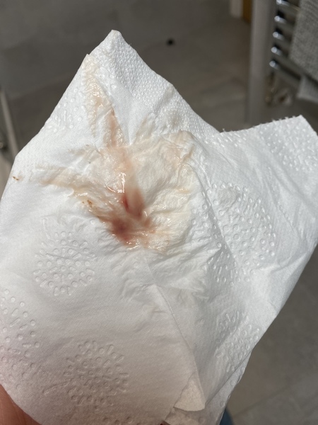 Could this be implantation bleeding? IMAGE INCLUDED