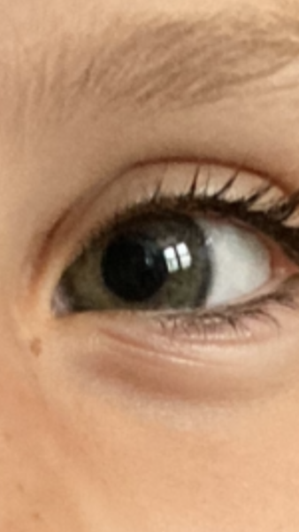 Eye colour