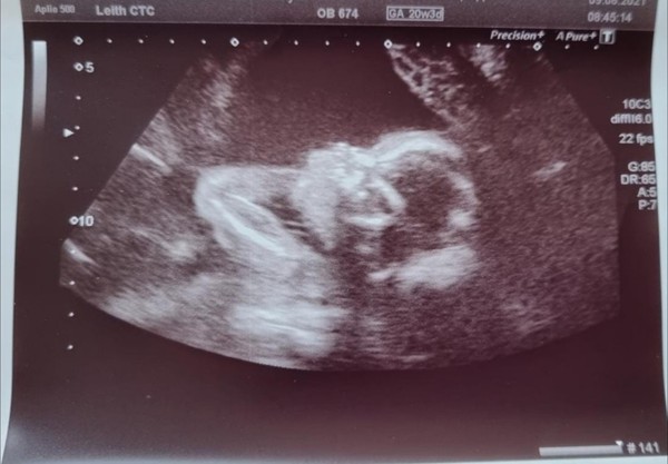 IVF Graduates due Late 2021/Early 2022