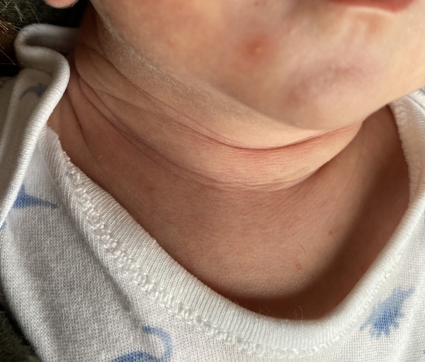 Three week old - does this just look like a spot, or something else?