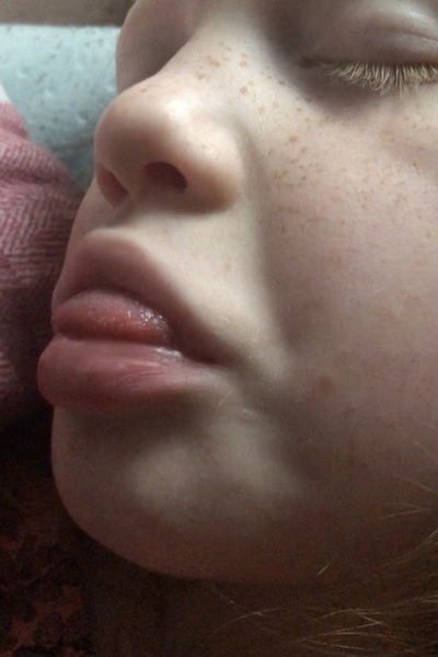 Does anyone else have a child that sucks their tongue while they sleep?