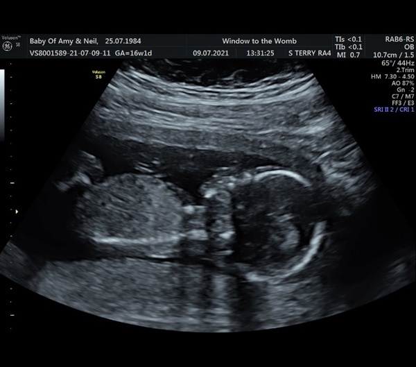 IVF Graduates due Late 2021/Early 2022