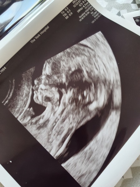 Due February 2022 (thread 2)