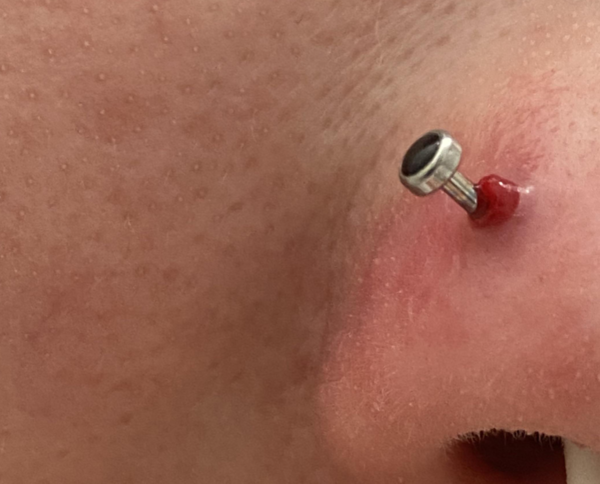 To think piercing a child's ears with a gun should be banned?