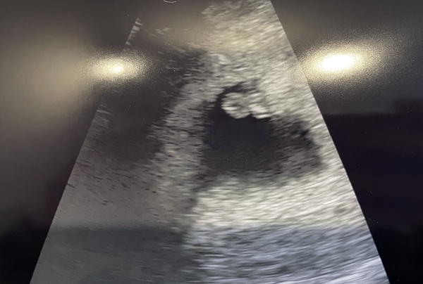 🤰🏼Due end of March/Beginning of April🤰🏾