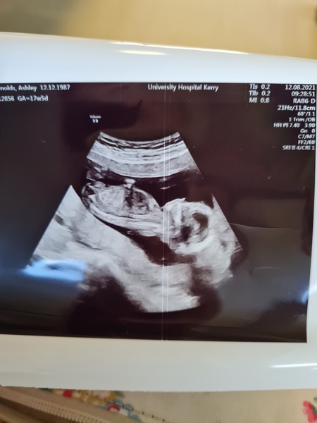 Gender scan photos, what do you think!