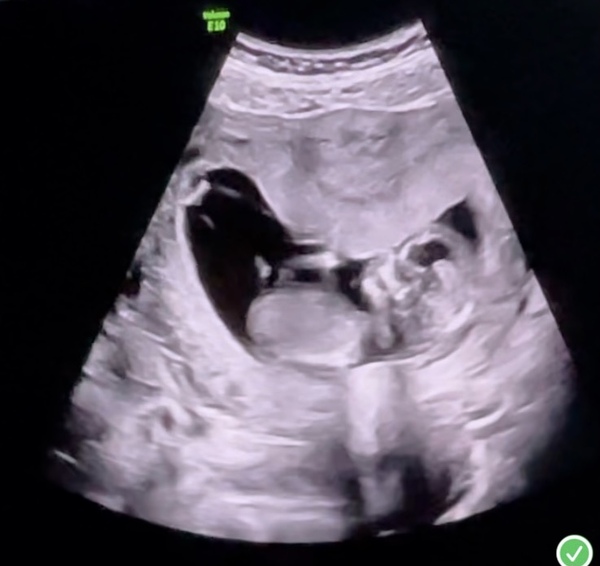 guess the sex of my baby