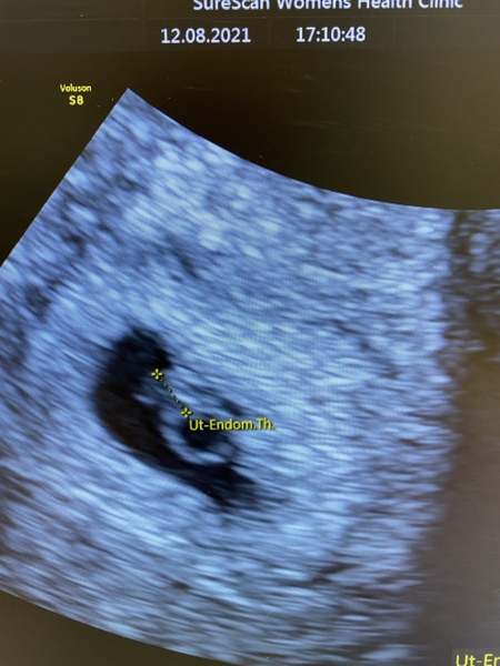🤰🏼Due end of March/Beginning of April🤰🏾