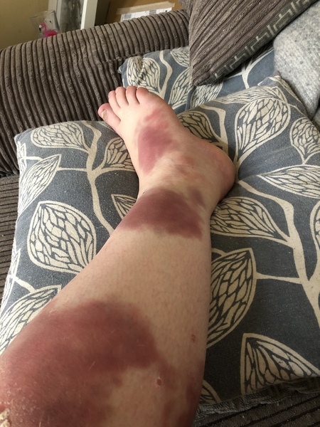 This is an A&E trip right?