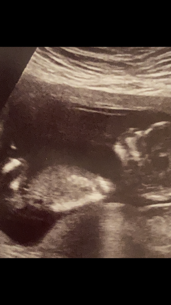 Just for fun- Girl or boy?
