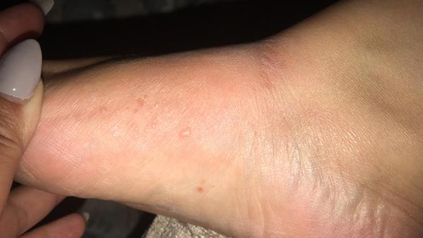 To once again ask you all what the heck is going on with me now!!!
