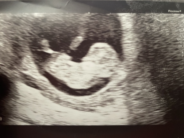 Just for fun! Guess my baby’s gender!
