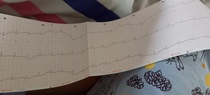 Can anyone read an ECG?