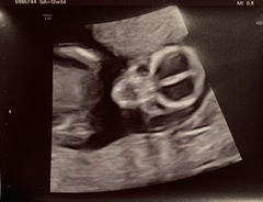 guess the sex of my baby