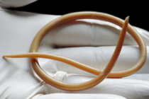 Help, I've got a tapeworm and it's messing with my head