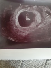 Gender guesses 💗💙💗💙