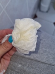 Pregnancy discharge or upcoming period? Sorry if TMI ( pic attached )