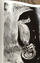 Boy or girl?