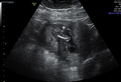 Could anyone help to identify whether we're having a boy or girl please?