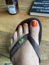 Are white toenails the only 'in' colour right now?