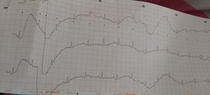 Can anyone read an ECG?