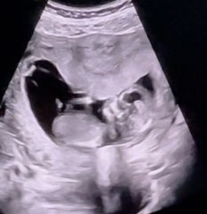 guess the sex of my baby