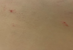 Bed bugs??!