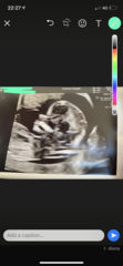 Boy or girl??