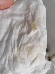 Panicking, and worried. *WARNING DISCHARGE PHOTOS*
