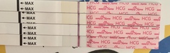 Progression lines?