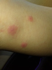 Spots