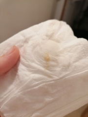 Panicking, and worried. *WARNING DISCHARGE PHOTOS*