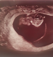 Gender guesses 💗💙💗💙