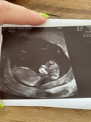 Due February 2022 (thread 2)