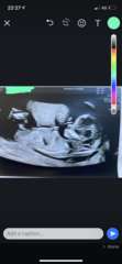 Boy or girl??