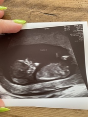 Due February 2022 (thread 2)