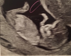 Guess sex from scan image??