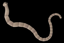 Help, I've got a tapeworm and it's messing with my head