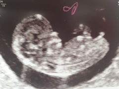 Guess sex from scan image??
