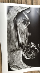 Boy or girl?