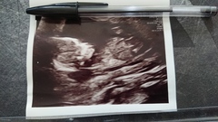 Baby Scan Photo Questions