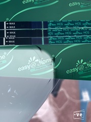 Progression lines?