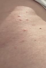 Bed bugs??!