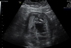 Could anyone help to identify whether we're having a boy or girl please?