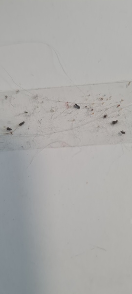 Bed bugs 😫 pic
