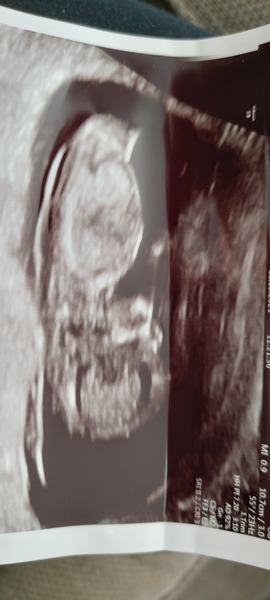 Guess the gender?!