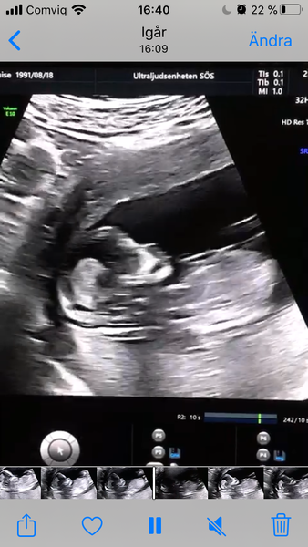 Due Mid March 2022